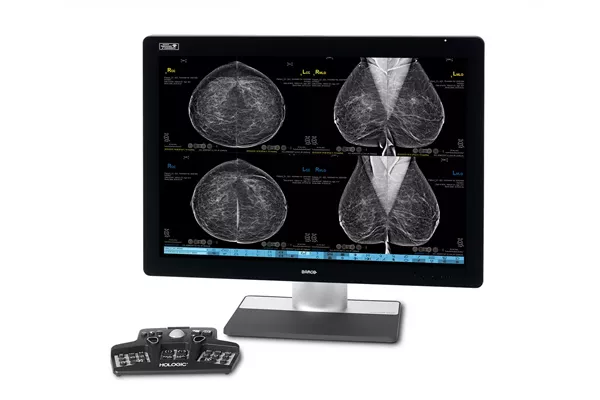 Moniteur affichant des images de mammographie avec un contrôleur sur fond blanc