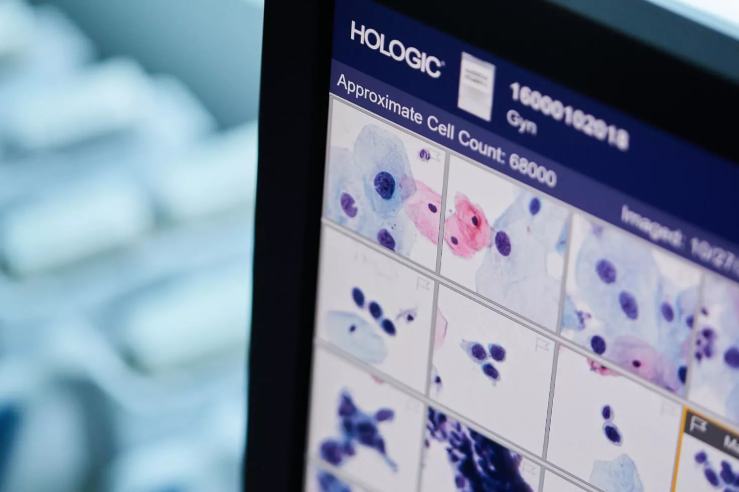 Gros plan sur un écran rempli d’images scannées avec le logo Hologic dans l’angle